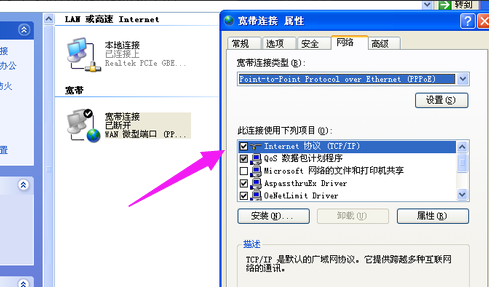设置本地连接 设置本地连接