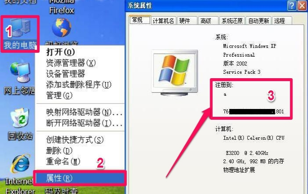 xp xp